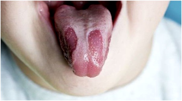 симптомы заболевания