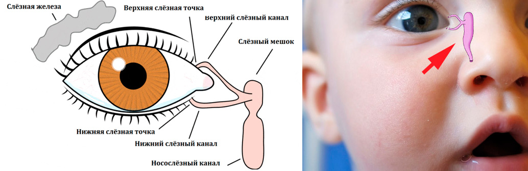 слезный мешок