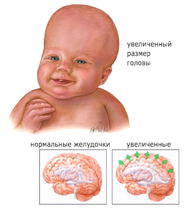 отклонения и норма