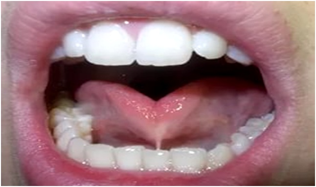 полный вариант