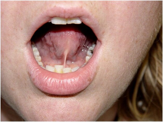 не полный вариант