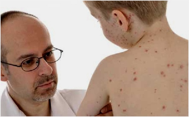 посыпало спину