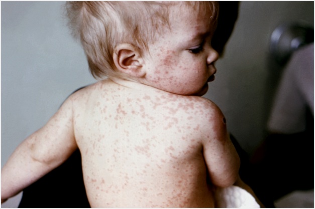 весь в точечку