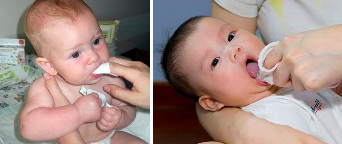 промывание содой