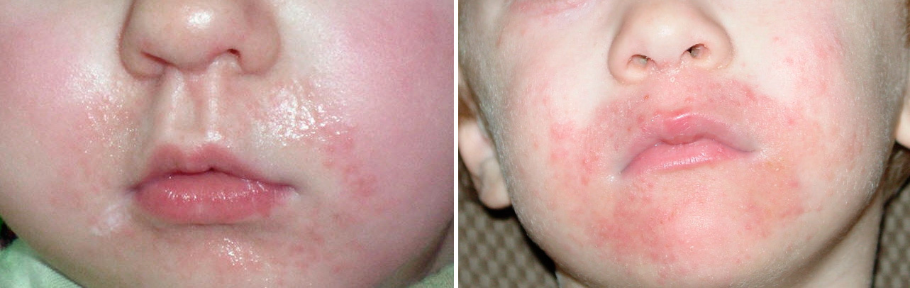 фото как выглядит