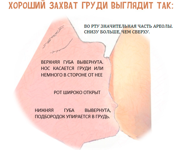 захват соска