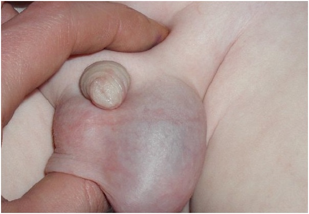 очень увеличено