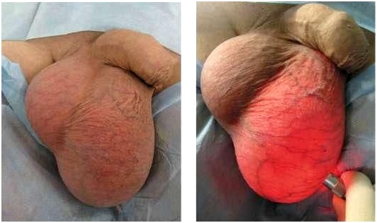 ультразвуковое исследование