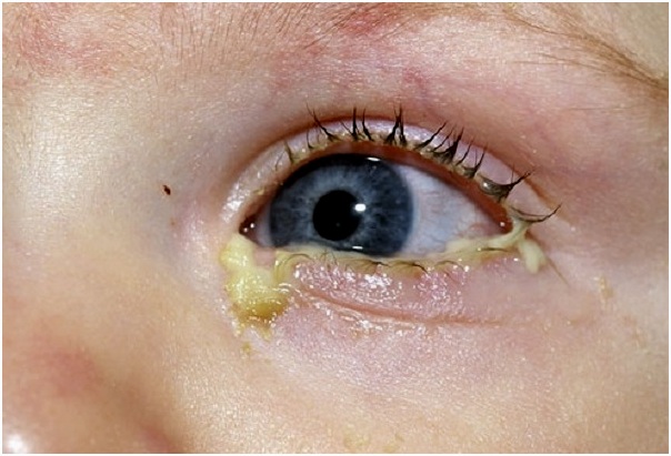 больной малыш