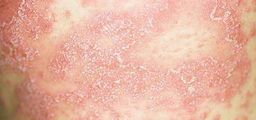 0653714e4ae35748e4a9d3b0a349f727