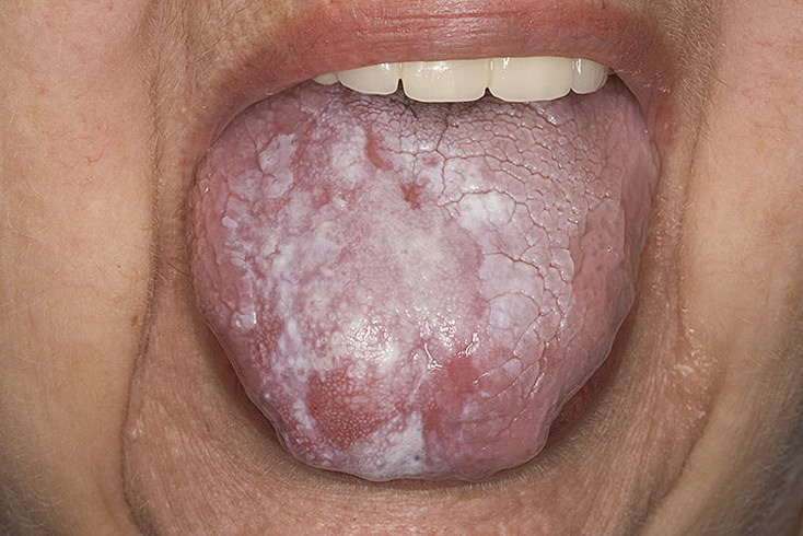 08_lishai_krasnii_ploskii_112205-a-foto