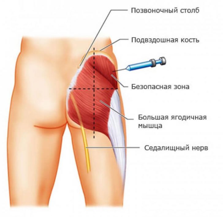 dimedrol