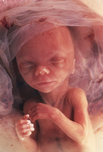 14 nedel beremennost