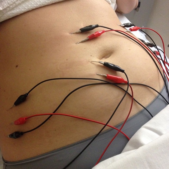 iglolipoliz-v-salone-krasotyi-poxudenie