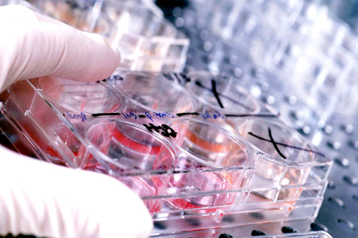 Анализ крови на АФП (анализ на альфа-фетопротеин)