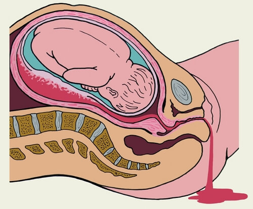 placenta