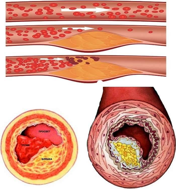lechenie-varikoza-v-virtus-otzyvy