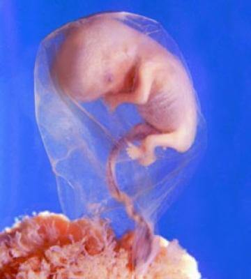 8 nedelya beremennosty