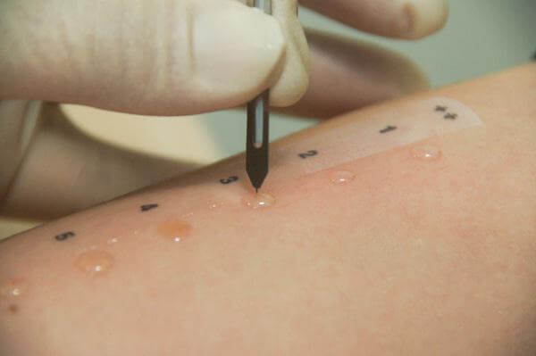 Как определить аллергический ринит