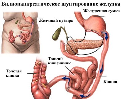 99708-travy-prostatita