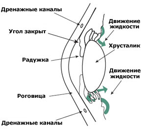 Angle-Closure-Glaucoma
