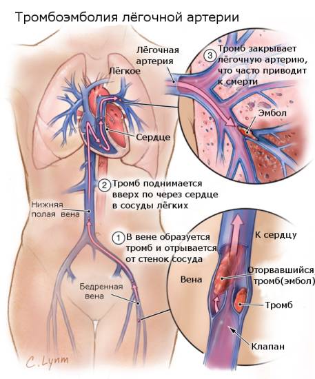 высокий уровень гемоглобина
