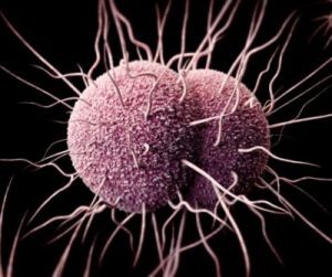 Gonoreja-u-muzhchin-simptomy-300x251