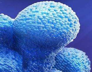 Анализ на РЭА (анализ на раково-эмбриональный антиген)