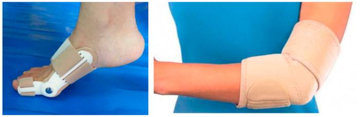 Методы лечения бурсита