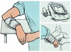 Как сделать компресс