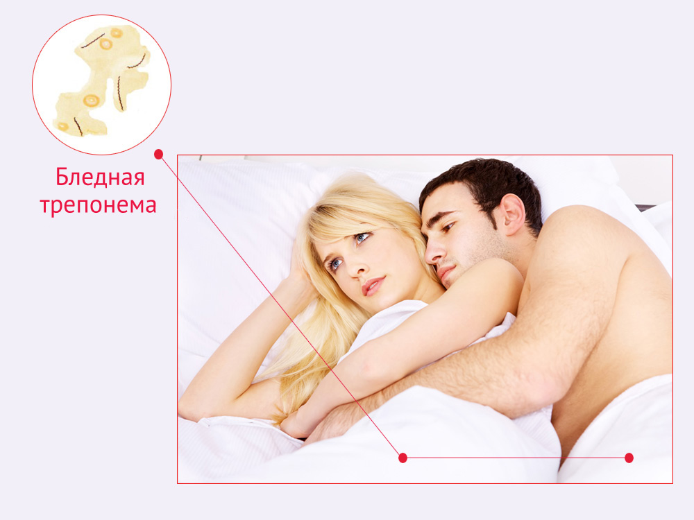 Kak-zarazhayutsya-sifilisom