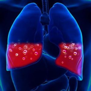 Legochnoe_krovotechenie