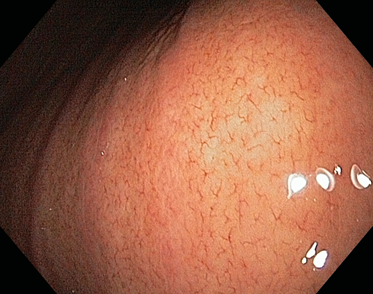 Оценка результатов