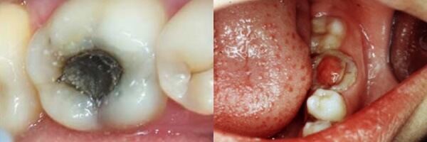 ostryj-pulpit-i-xronicheskij-pulpit-1