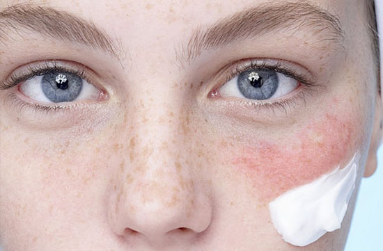 Что делать, если у вас сверхчувствительная кожа?