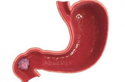 best_9a1d7b9ed6-4-daday4-kienthuc-ngnt