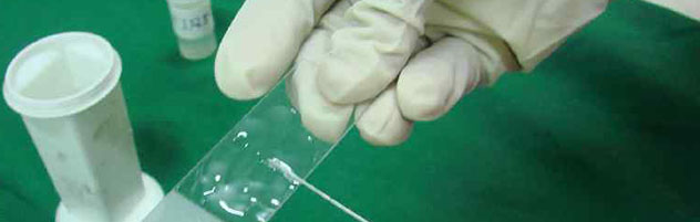 citologicheskoe-issledovanie2