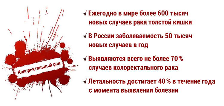 colon-cancer-rak-tolstoj-kishki (1)