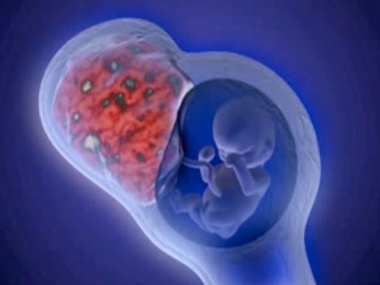 f37bc71be1e9a07c6f6d207b90e63341