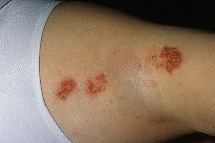 Хейли-Хейли