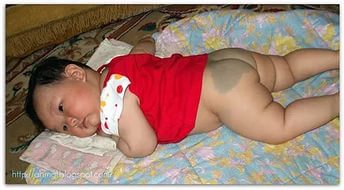 Монгольское пятно