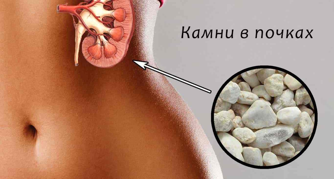 kamni-v-pochkax