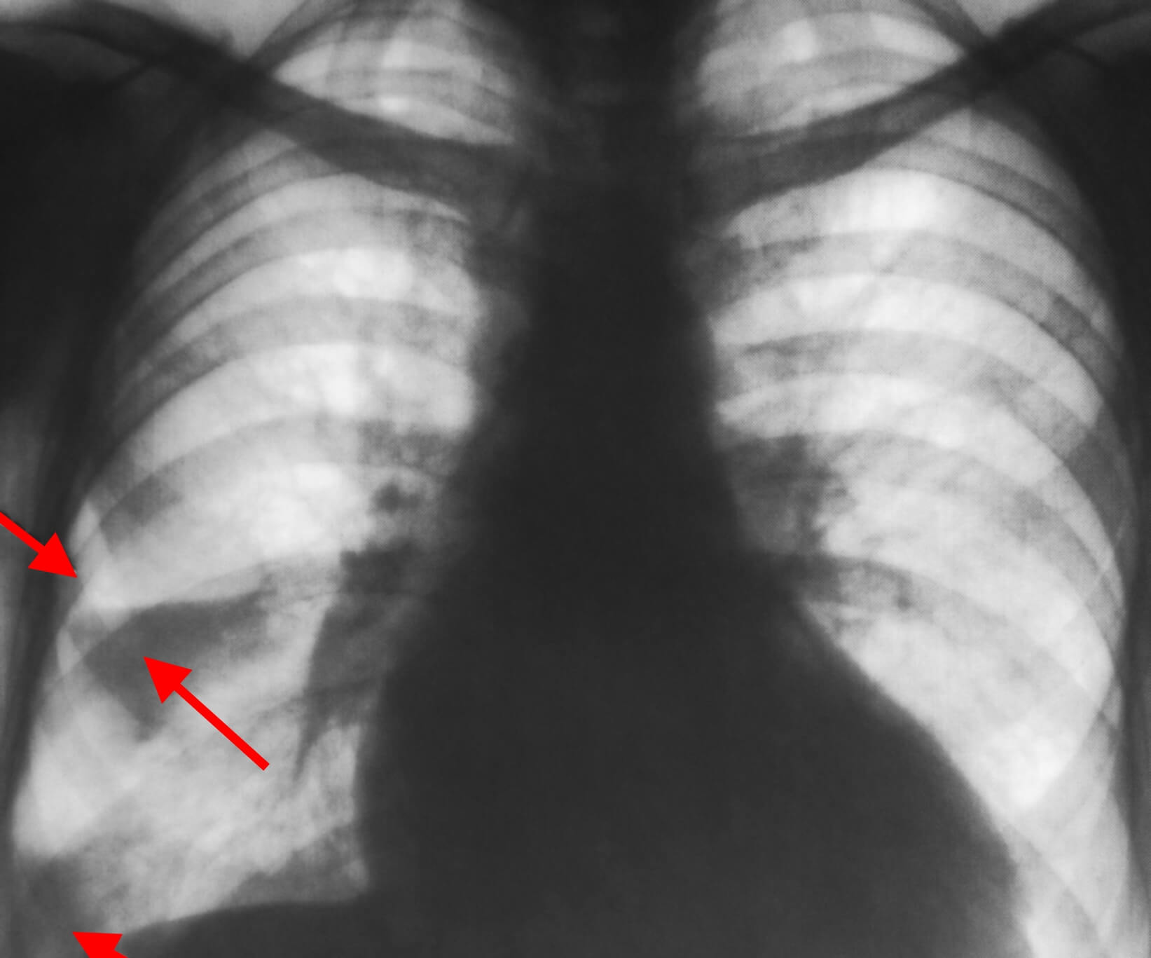 kt-i-rentgen-diagnos-narusheniy-leg-krovoobrasheniya (24) (1)