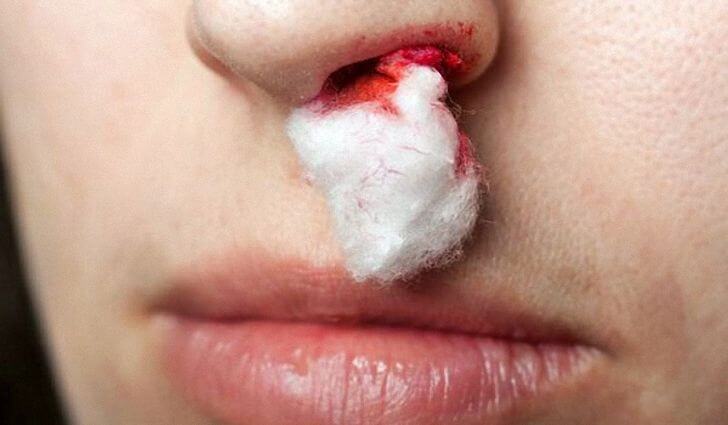 lechenie-polipov-operaciej