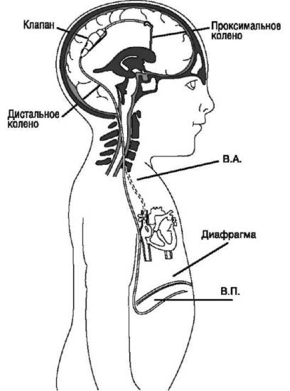 Оперативное лечение