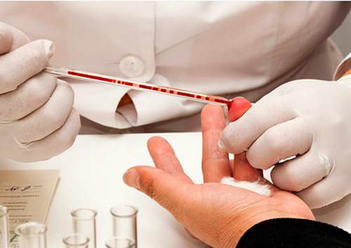 obschiy_analiz_krovi