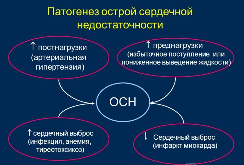 Виды, типы и формы сердечной недостаточности