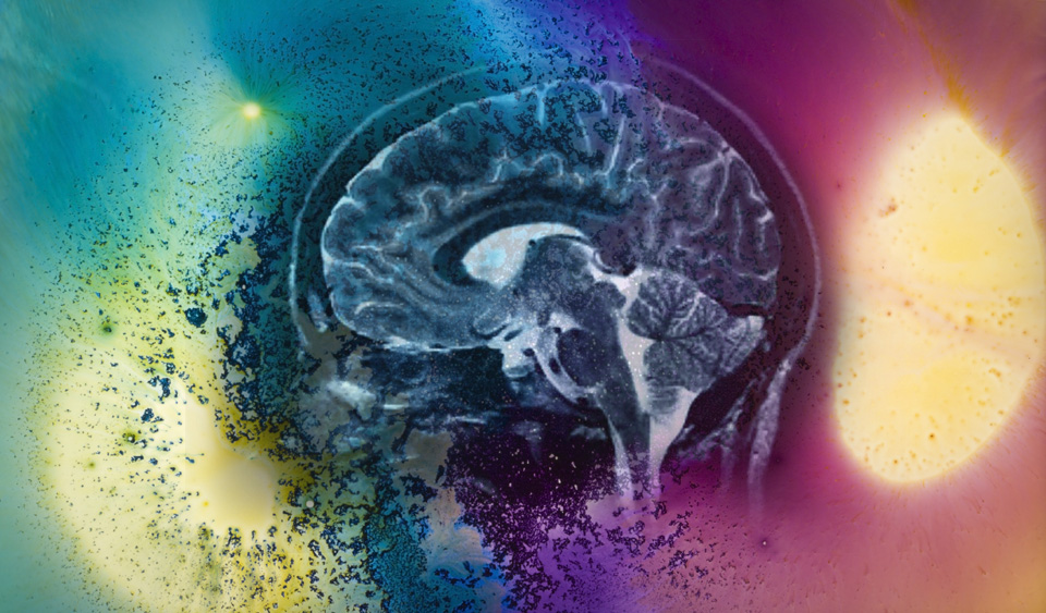 Тошнота, головная боль и сонливость – интоксикация нервной системы