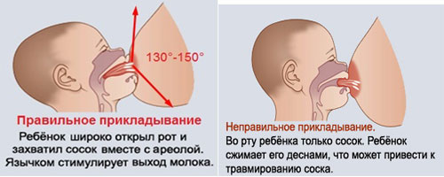 pravilnoe-prikladyvanie-k-grudi