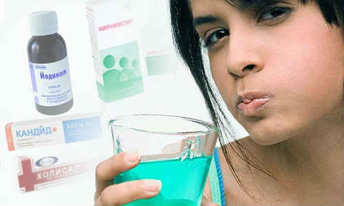 stomatit-u-vzroslyh-prichiny-i-lechenie